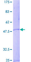 CRH / CRF Protein - 12.5% SDS-PAGE of human CRH stained with Coomassie Blue