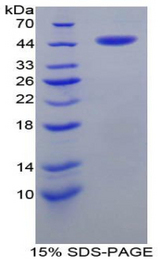 CRH / CRF Protein - Recombinant Corticotropin Releasing Hormone By SDS-PAGE