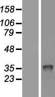 CRHBP Protein - Western validation with an anti-DDK antibody * L: Control HEK293 lysate R: Over-expression lysate