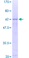 CRHBP Protein - 12.5% SDS-PAGE of human CRHBP stained with Coomassie Blue