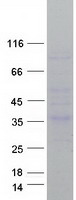 CRHBP Protein - Purified recombinant protein CRHBP was analyzed by SDS-PAGE gel and Coomassie Blue Staining