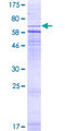 CRHR2 / CRF2 Receptor Protein - 12.5% SDS-PAGE of human CRHR2 stained with Coomassie Blue