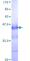 CRIM1 Protein - 12.5% SDS-PAGE Stained with Coomassie Blue.