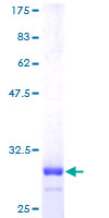 CRIP1 Protein - 12.5% SDS-PAGE of human CRIP1 stained with Coomassie Blue