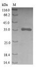 CRIP1 Protein - (Tris-Glycine gel) Discontinuous SDS-PAGE (reduced) with 5% enrichment gel and 15% separation gel.