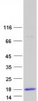 CRIP1 Protein - Purified recombinant protein CRIP1 was analyzed by SDS-PAGE gel and Coomassie Blue Staining