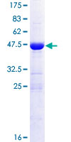 CRIP2 Protein - 12.5% SDS-PAGE of human CRIP2 stained with Coomassie Blue
