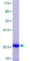 CRIP2 Protein - 12.5% SDS-PAGE Stained with Coomassie Blue.