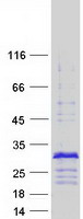 CRIP2 Protein - Purified recombinant protein CRIP2 was analyzed by SDS-PAGE gel and Coomassie Blue Staining