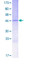 CRIP3 Protein - 12.5% SDS-PAGE of human CRIP3 stained with Coomassie Blue