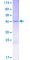 CRIP3 Protein - 12.5% SDS-PAGE of human CRIP3 stained with Coomassie Blue