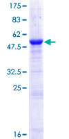 CRISP1 Protein - 12.5% SDS-PAGE of human CRISP1 stained with Coomassie Blue