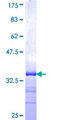 CRISP2 / TSP1 Protein - 12.5% SDS-PAGE Stained with Coomassie Blue.