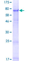 CRISPLD1 Protein - 12.5% SDS-PAGE of human CRISPLD1 stained with Coomassie Blue