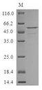 CRISPLD2 Protein - (Tris-Glycine gel) Discontinuous SDS-PAGE (reduced) with 5% enrichment gel and 15% separation gel.