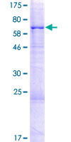 CRISPLD2 Protein - 12.5% SDS-PAGE of human CRISPLD2 stained with Coomassie Blue