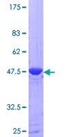 CRK Protein - 12.5% SDS-PAGE of human CRK stained with Coomassie Blue