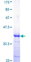 CRK Protein - 12.5% SDS-PAGE Stained with Coomassie Blue.
