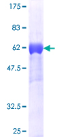 CRKL Protein - 12.5% SDS-PAGE of human CRKL stained with Coomassie Blue