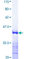 CRKL Protein - 12.5% SDS-PAGE Stained with Coomassie Blue.