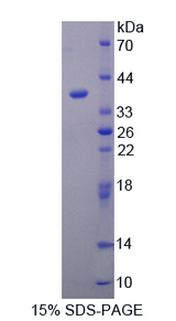 CRKL Protein - Recombinant  Crk Like Protein By SDS-PAGE