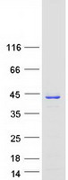 CRKL Protein - Purified recombinant protein CRKL was analyzed by SDS-PAGE gel and Coomassie Blue Staining