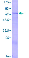 CRLF1 Protein - 12.5% SDS-PAGE of human CRLF1 stained with Coomassie Blue