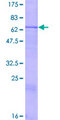 CRLF1 Protein - 12.5% SDS-PAGE of human CRLF1 stained with Coomassie Blue