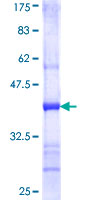 CRLF1 Protein - 12.5% SDS-PAGE Stained with Coomassie Blue.