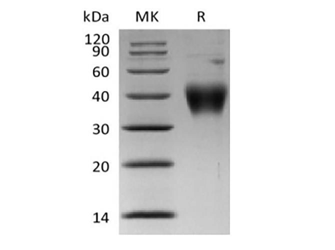 CRLF2 / TSLPR Protein - Recombinant Human Thymic Stromal Lymphopoietin Receptor/TSP R/CRLF2 (C-6His)