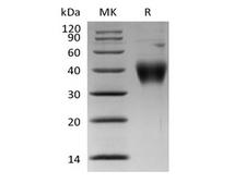 CRLF2 / TSLPR Protein - Recombinant Human Thymic Stromal Lymphopoietin Receptor/TSP R/CRLF2 (C-6His)