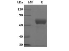 CRLF2 / TSLPR Protein - Recombinant Human TSLP R/CRLF2 (C-Fc)