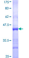 CRLF2 / TSLPR Protein - 12.5% SDS-PAGE Stained with Coomassie Blue.