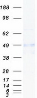 CRLF2 / TSLPR Protein - Purified recombinant protein CRLF2 was analyzed by SDS-PAGE gel and Coomassie Blue Staining