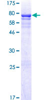 CRLF3 Protein - 12.5% SDS-PAGE of human CRLF3 stained with Coomassie Blue