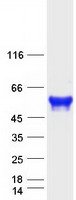 CRLF3 Protein - Purified recombinant protein CRLF3 was analyzed by SDS-PAGE gel and Coomassie Blue Staining