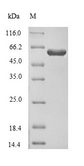 CRMP1 Protein - (Tris-Glycine gel) Discontinuous SDS-PAGE (reduced) with 5% enrichment gel and 15% separation gel.
