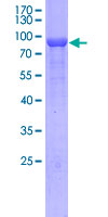 CRMP1 Protein - 12.5% SDS-PAGE of human CRMP1 stained with Coomassie Blue