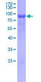 CRMP1 Protein - 12.5% SDS-PAGE of human CRMP1 stained with Coomassie Blue