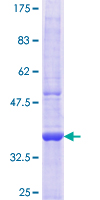 CRMP1 Protein - 12.5% SDS-PAGE Stained with Coomassie Blue.