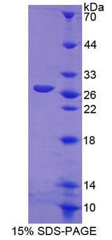 CRMP1 Protein - Recombinant Collapsin Response Mediator Protein 1 By SDS-PAGE