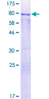 CRNN / Cornulin Protein - 12.5% SDS-PAGE of human CRNN stained with Coomassie Blue