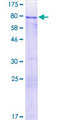CRNN / Cornulin Protein - 12.5% SDS-PAGE of human CRNN stained with Coomassie Blue