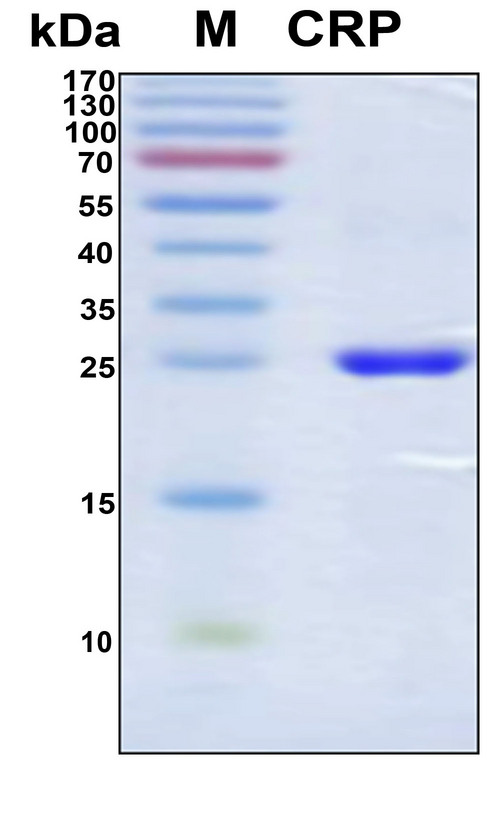CRP / C-Reactive Protein Protein - SDS-PAGE under reducing conditions and visualized by Coomassie blue staining