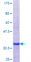 CRP / C-Reactive Protein Protein - 12.5% SDS-PAGE of human CRP stained with Coomassie Blue