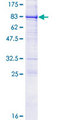 CRTAM Protein - 12.5% SDS-PAGE of human CRTAM stained with Coomassie Blue