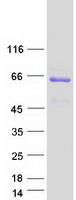 CRTAP Protein - Purified recombinant protein CRTAP was analyzed by SDS-PAGE gel and Coomassie Blue Staining