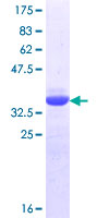CRTC1 / MECT1 / TORC1 Protein - 12.5% SDS-PAGE Stained with Coomassie Blue.