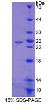 CRTC1 / MECT1 / TORC1 Protein - Recombinant CREB Regulated Transcription Coactivator 1 (CRTC1) by SDS-PAGE