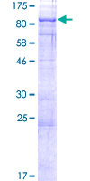 CRTC2 / TORC2 Protein - 12.5% SDS-PAGE of human CRTC2 stained with Coomassie Blue